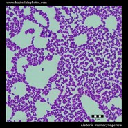 listeria monocytogenes microscopy